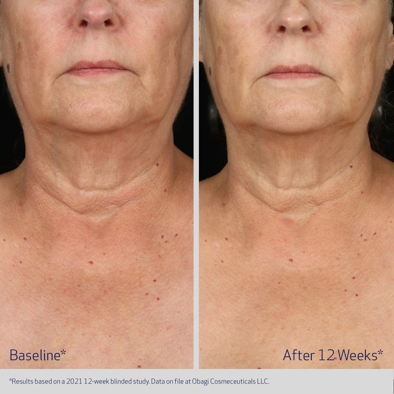 ELASTIderm® Neck and Décolleté Concentrate