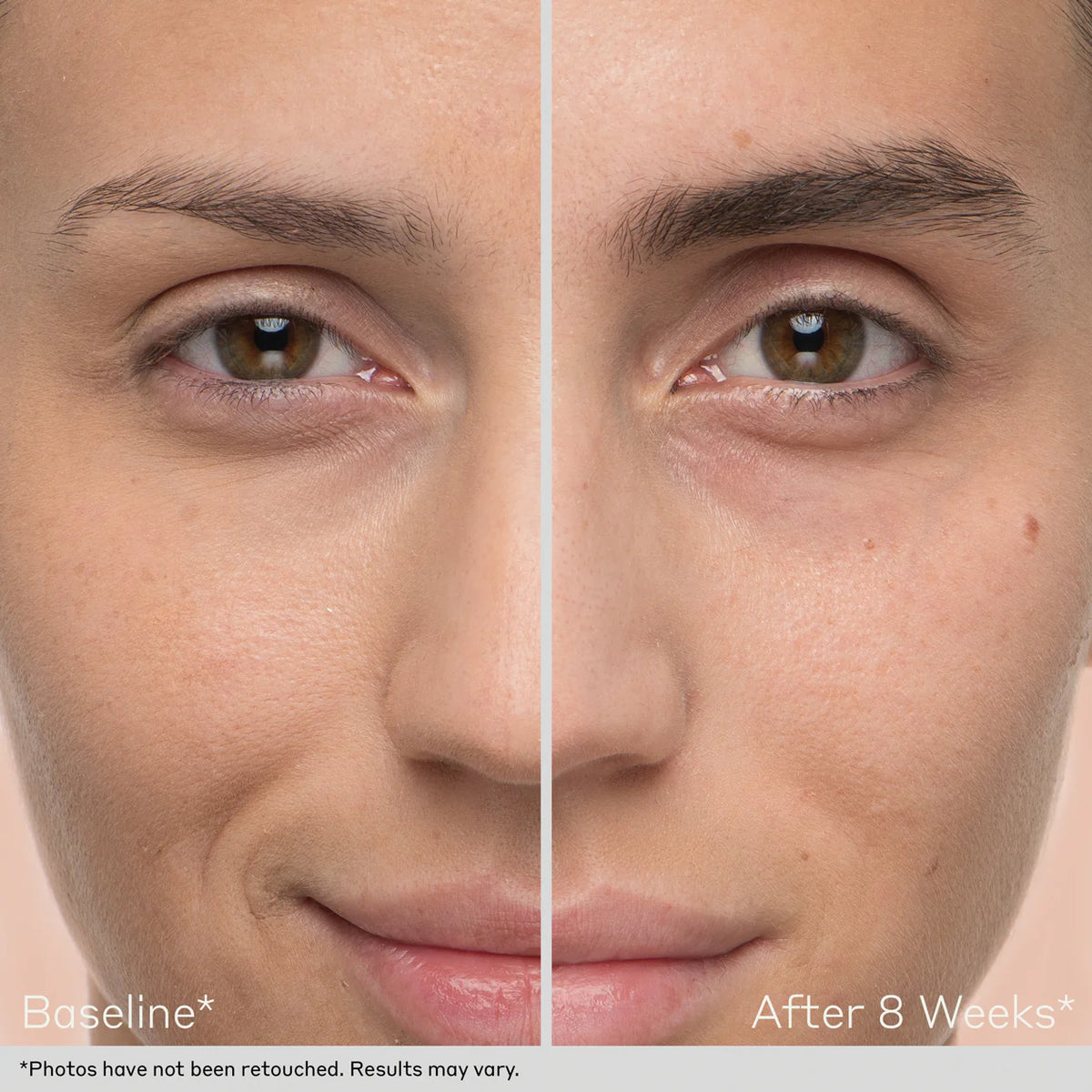 Obagi Nu-Cil™ Eyebrow Boosting Serum – Centro de Dermatología