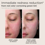EltaMD UV Skin Recovery Red Color Correcting Green Tint Broad Spectrum SPF 50