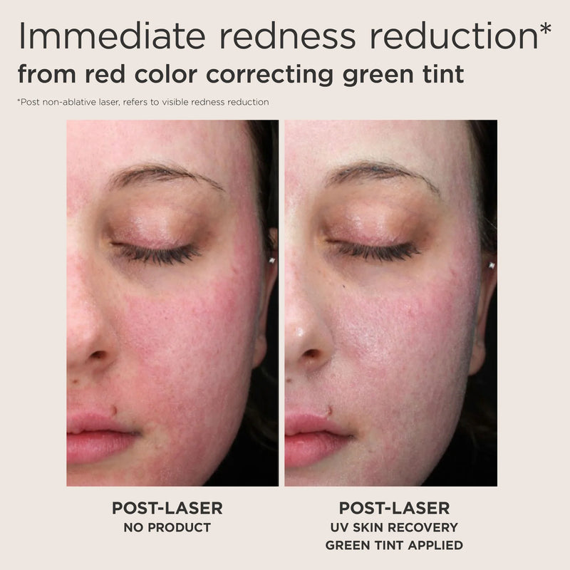EltaMD UV Skin Recovery Red Color Correcting Green Tint Broad Spectrum SPF 50