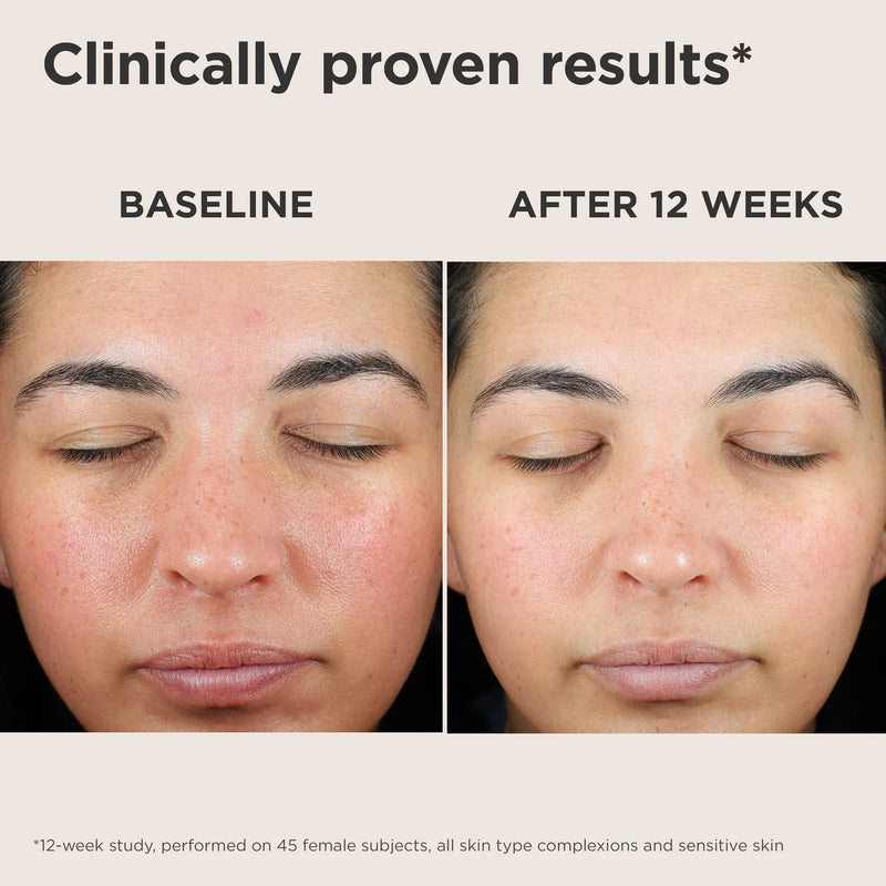 EltaMD UV Skin Recovery Red Color Correcting Green Tint Broad Spectrum SPF 50